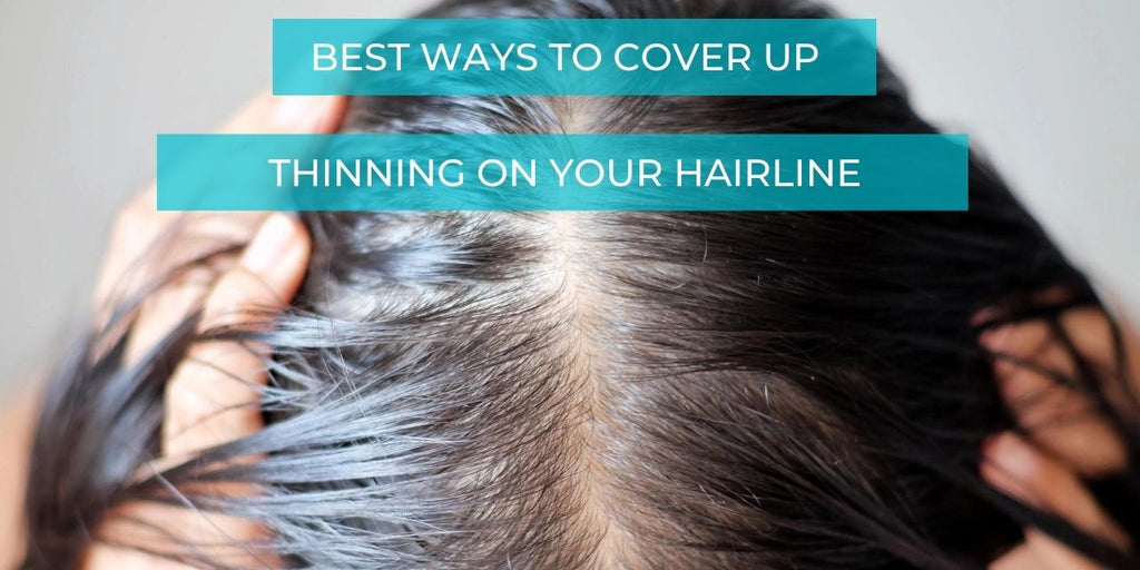 How To Cover Up Thinning On Your Hairline