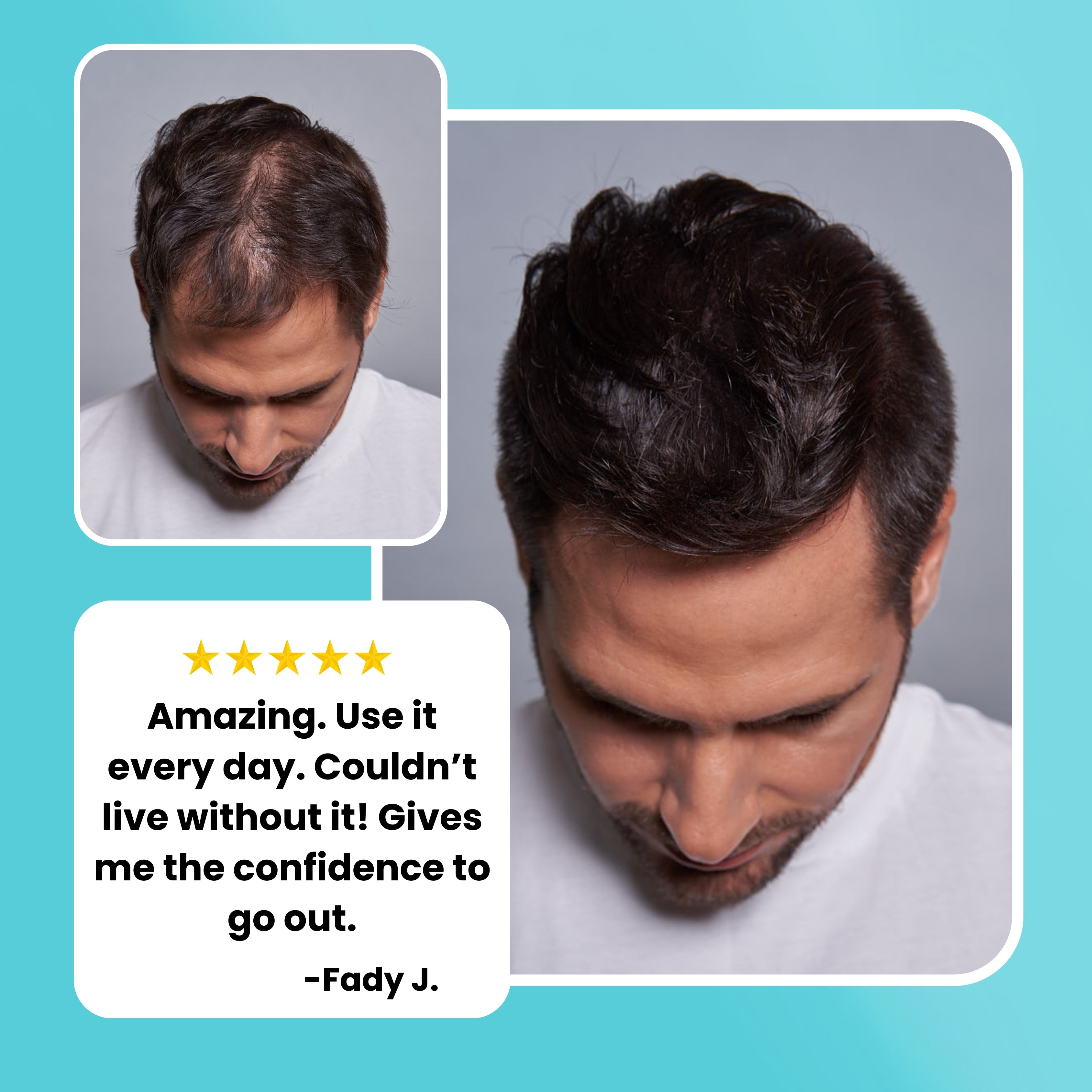 Hair Thickening Fibers (15g) + Application Tools (31% SAVINGS)
