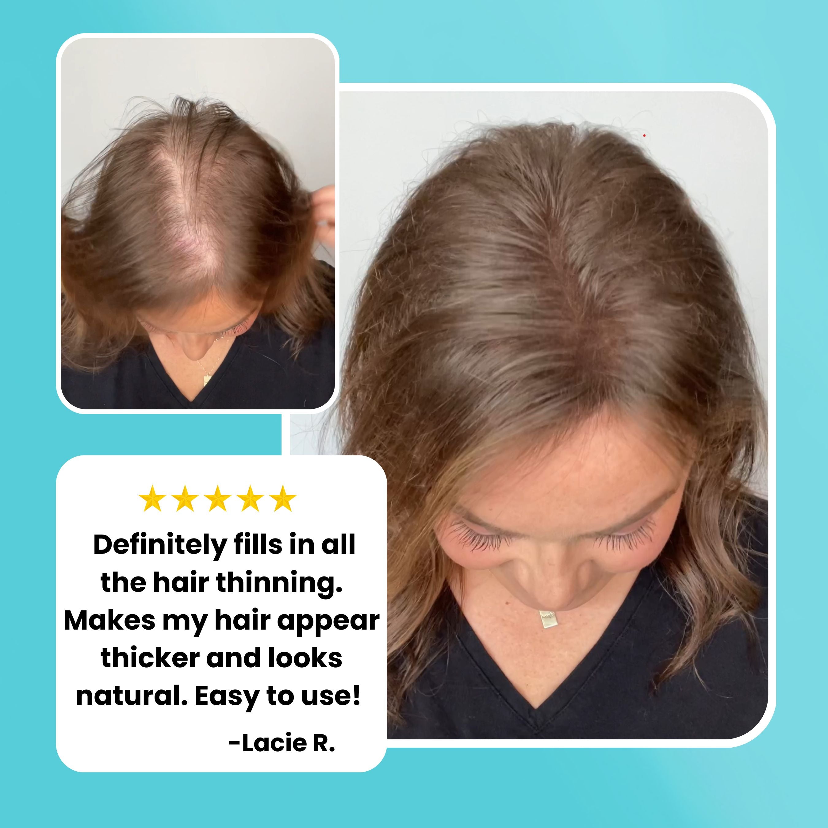 Hair Thickening Fibers (15g) + Application Tools (31% SAVINGS)