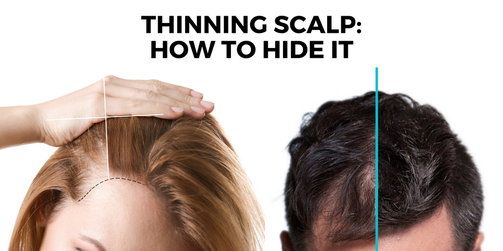 How to hide your scalp if you have thinning hair?