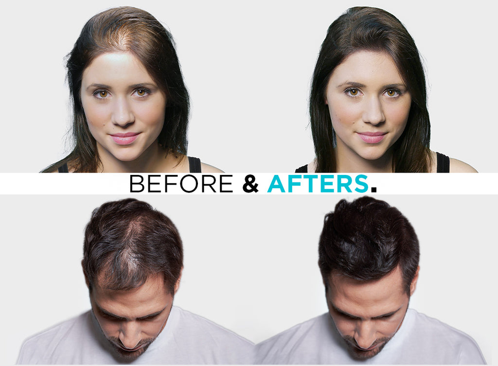 HAIR FIBERS FOR THINNING HAIR BY SURETHIK CANADA